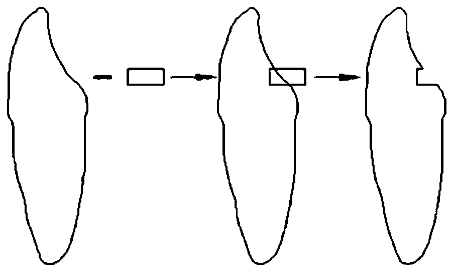 Invisible aligner with pressure attachment and method of making the same