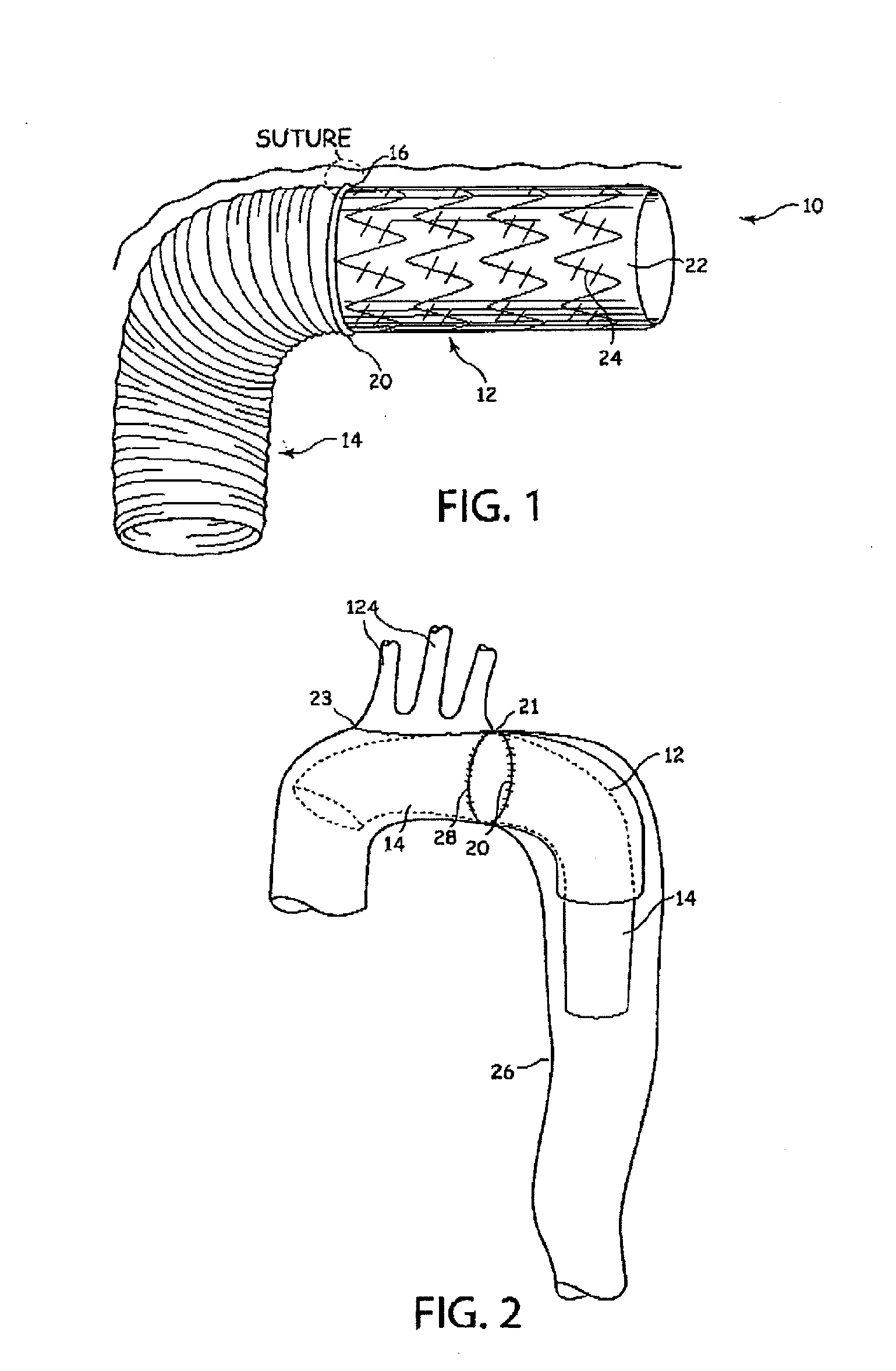 Aortic graft device