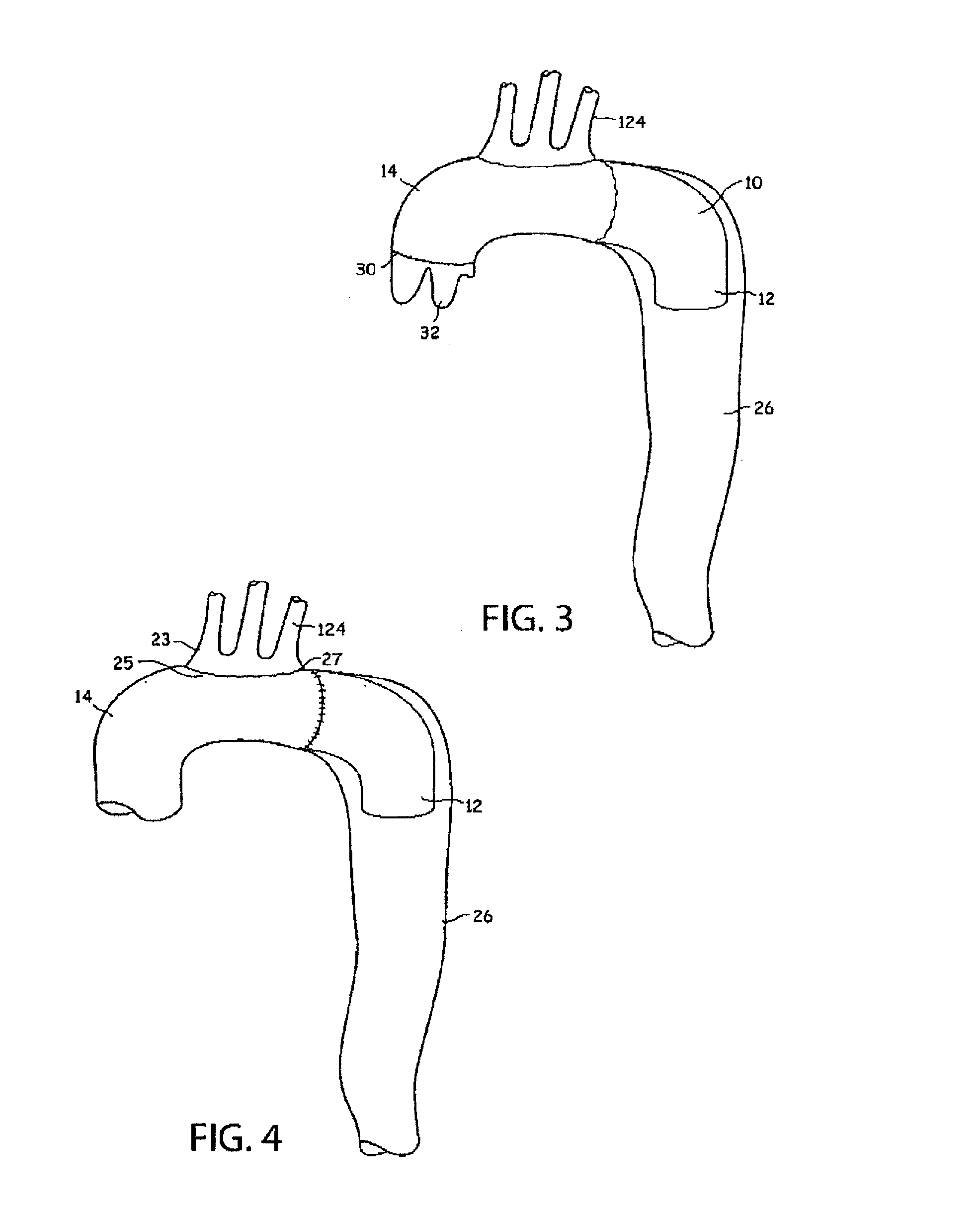 Aortic graft device