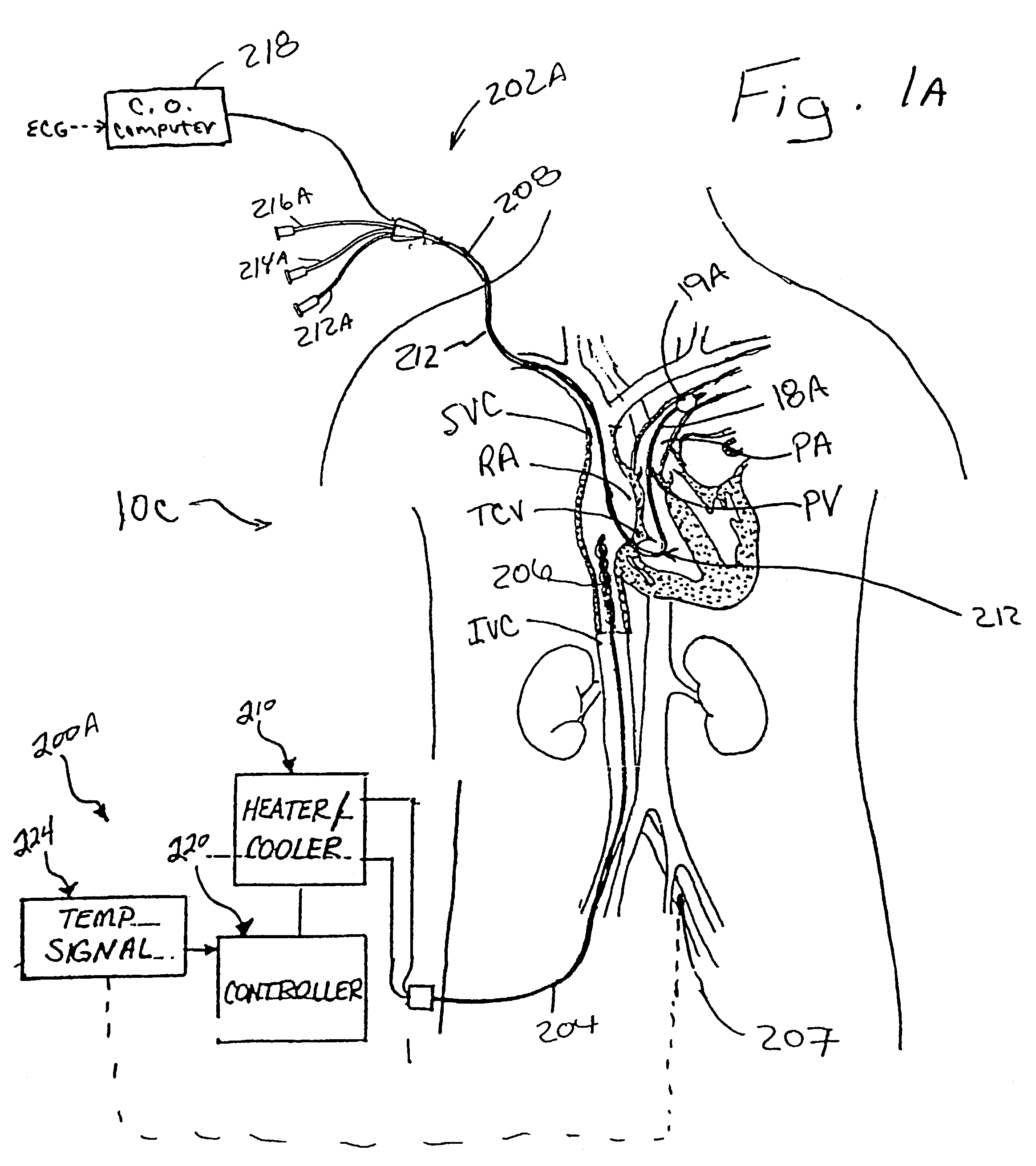 Devices and methods for measuring blood flow rate or cardiac output and for heating or cooling the body