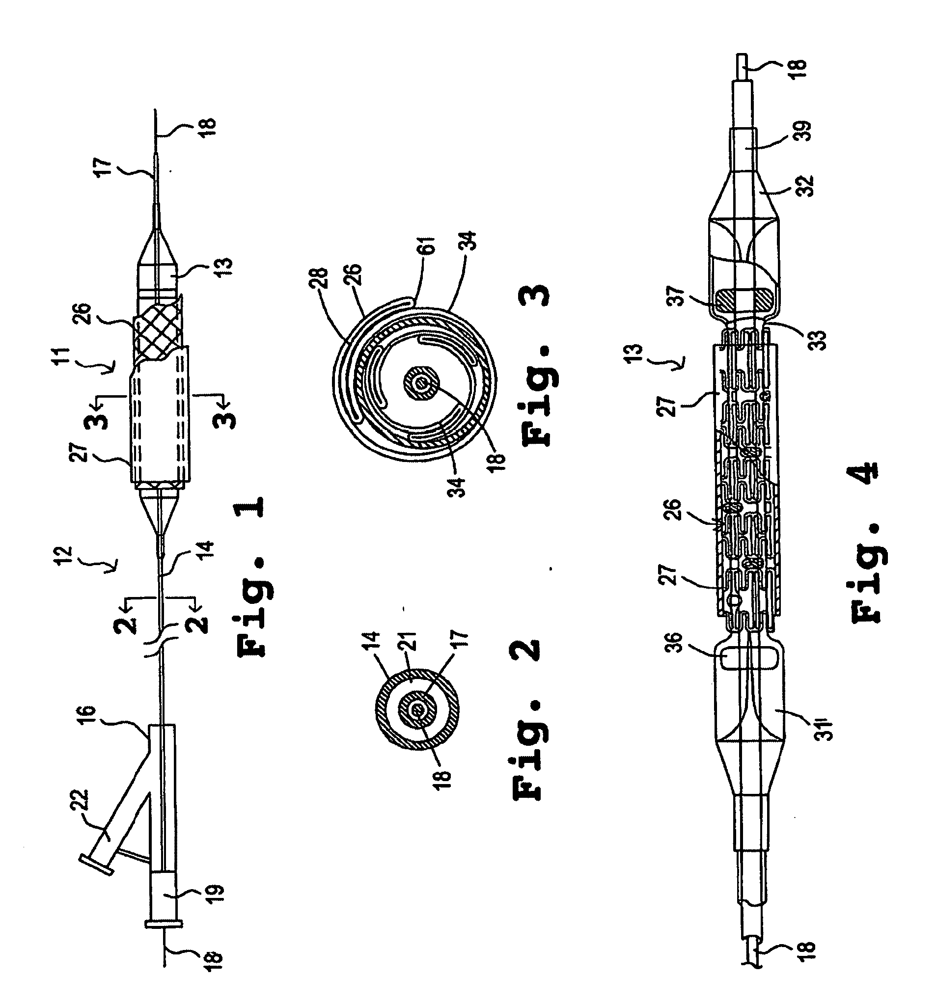 Composite stent with polymeric covering and bioactive coating