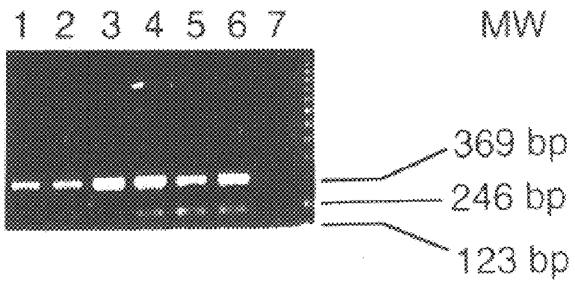 Isolated nucleic acid molecule encoding an esophageal cancer associated antigen, the antigen itself, and uses thereof