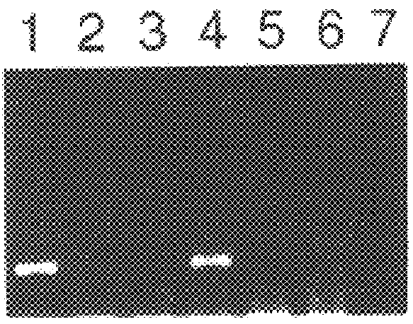 Isolated nucleic acid molecule encoding an esophageal cancer associated antigen, the antigen itself, and uses thereof