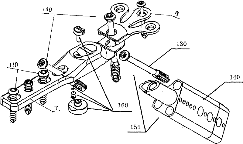 Proximal thighbone internal fixation system with minimal invasion