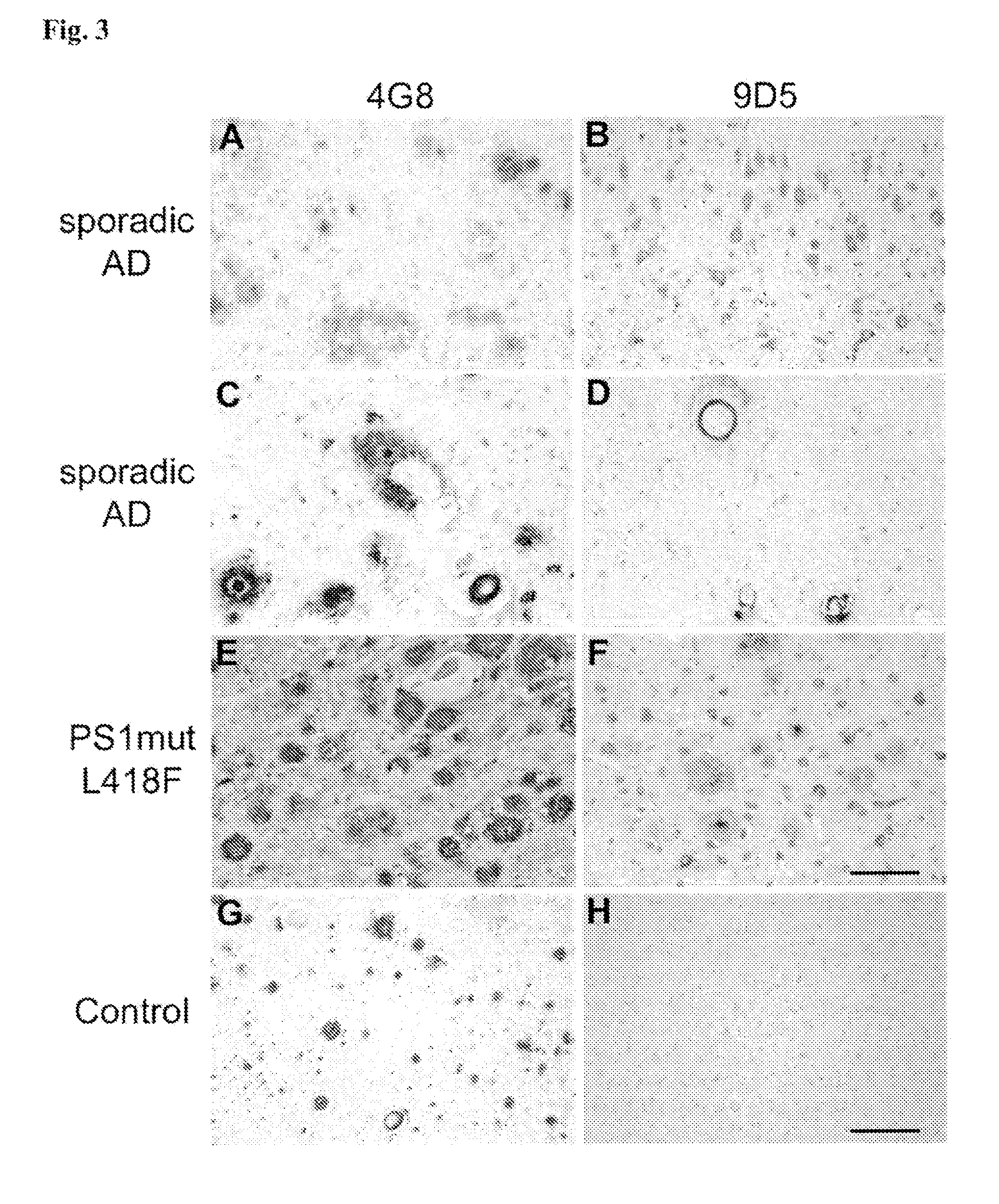 Monoclonal antibodies targeting amyloid beta oligomers