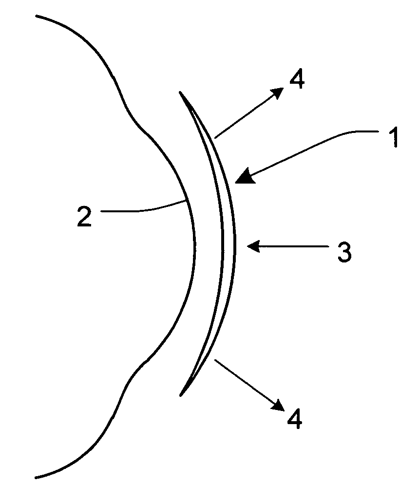 Contact lens used in orthokeratology