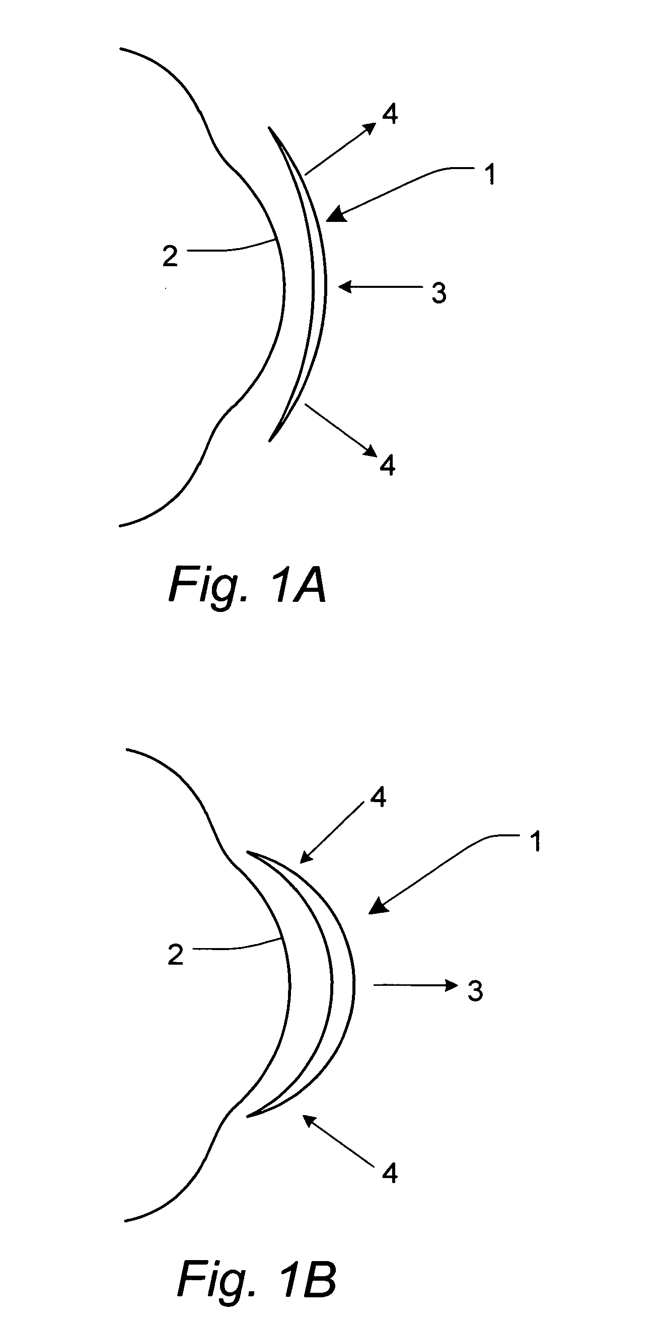 Contact lens used in orthokeratology