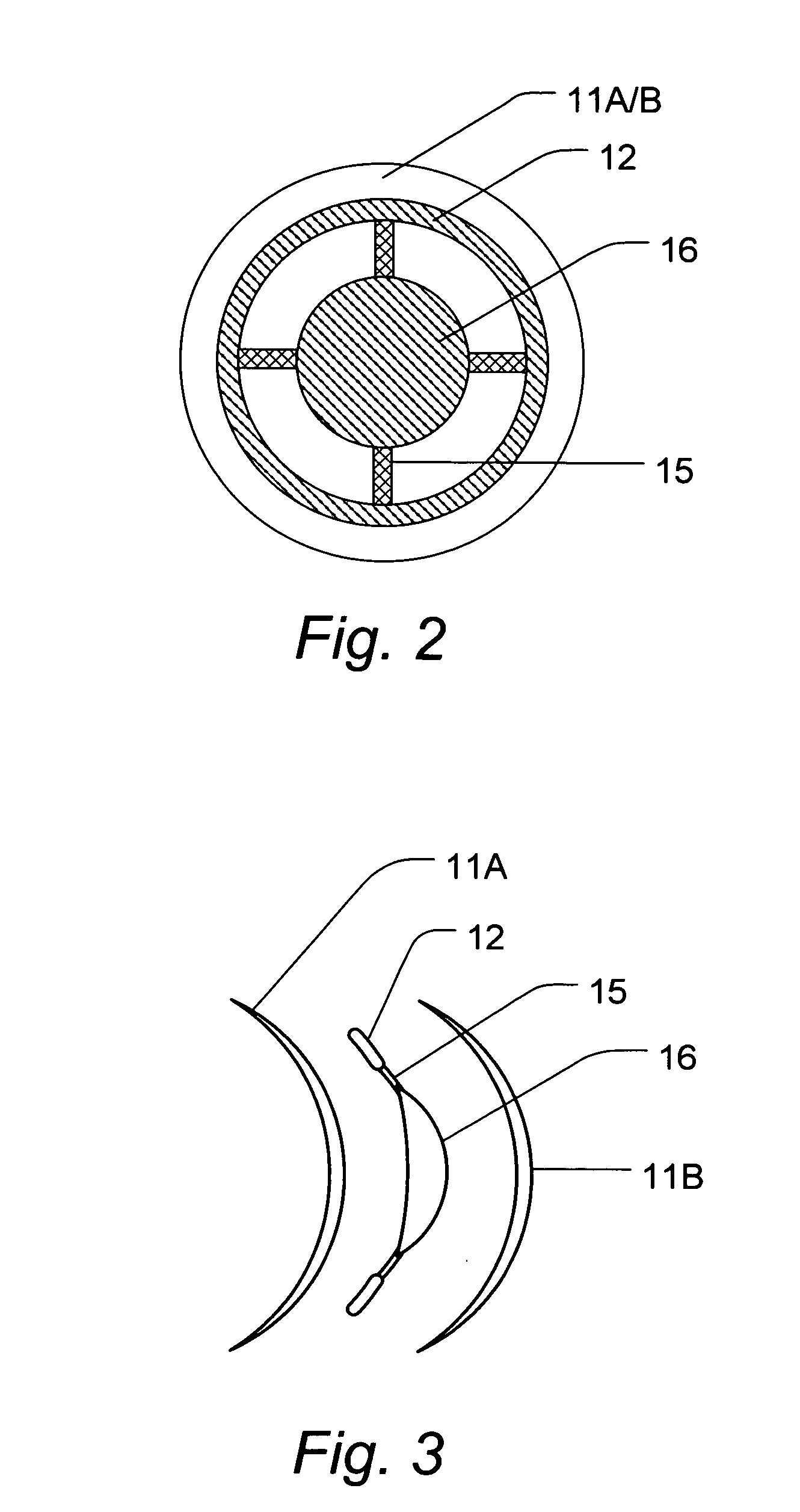 Contact lens used in orthokeratology