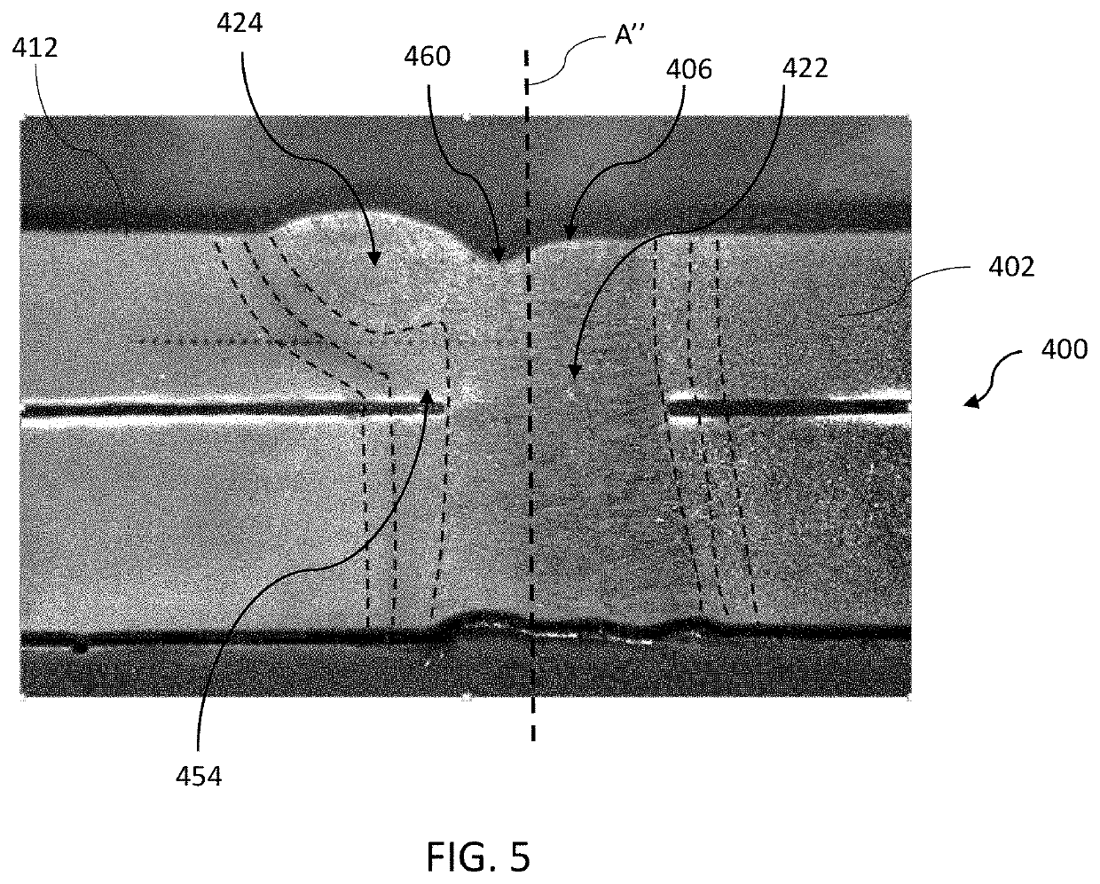 Laser welded assembly having a heat affected zone reinforcement and method of making the same