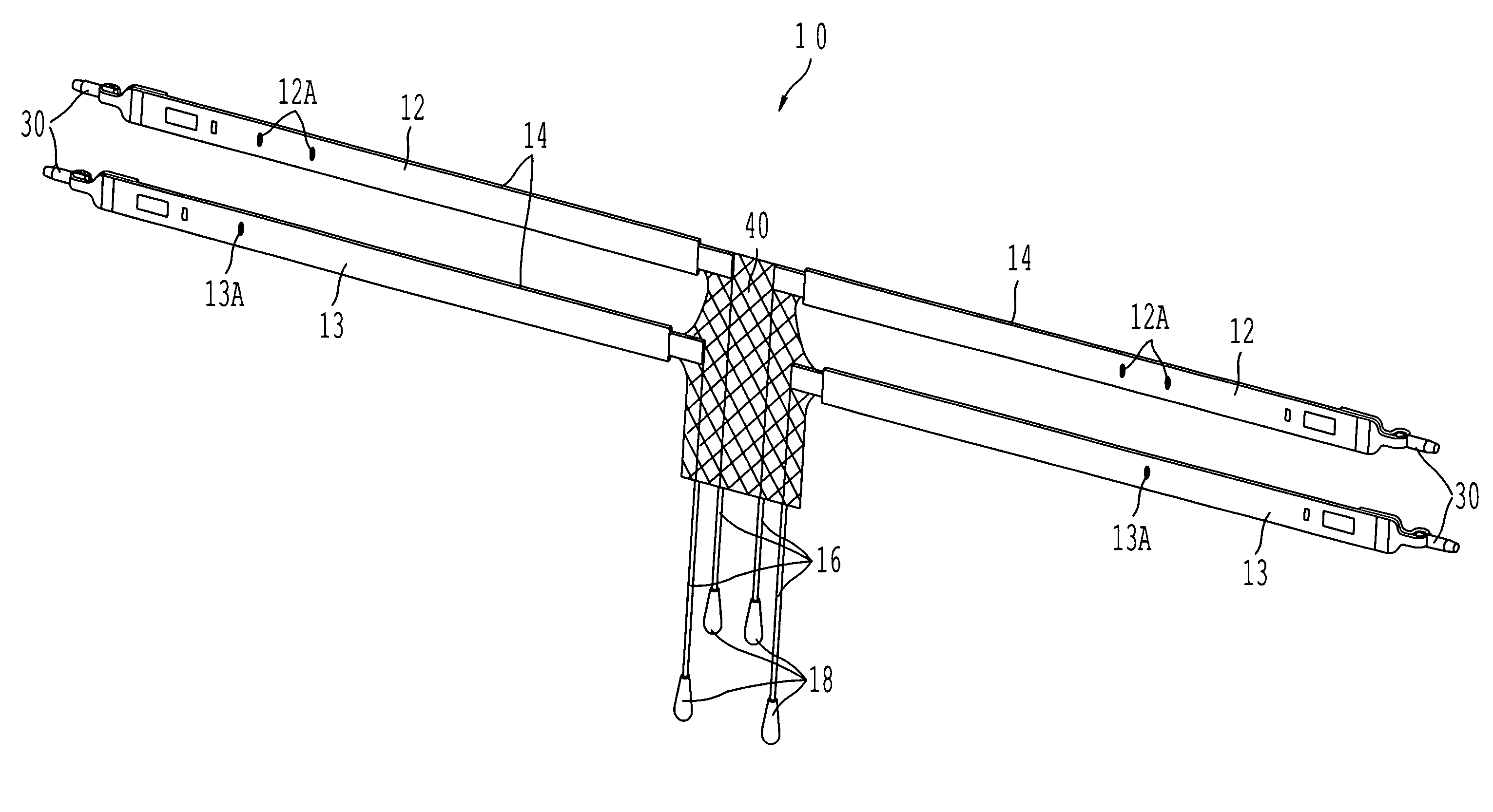 Method and apparatus for cystocele repair