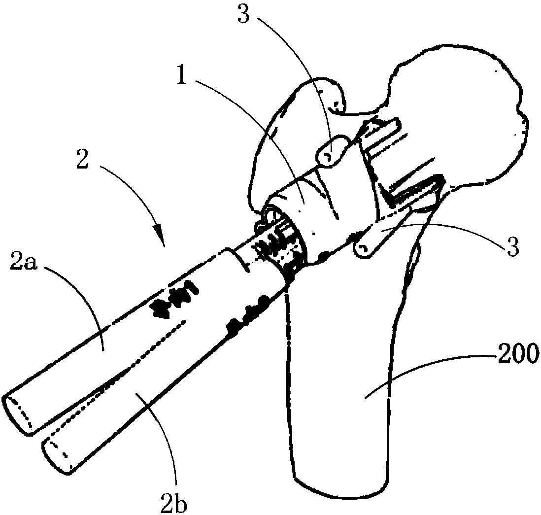 Femoral head collapse repair device