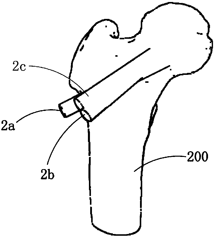 Femoral head collapse repair device