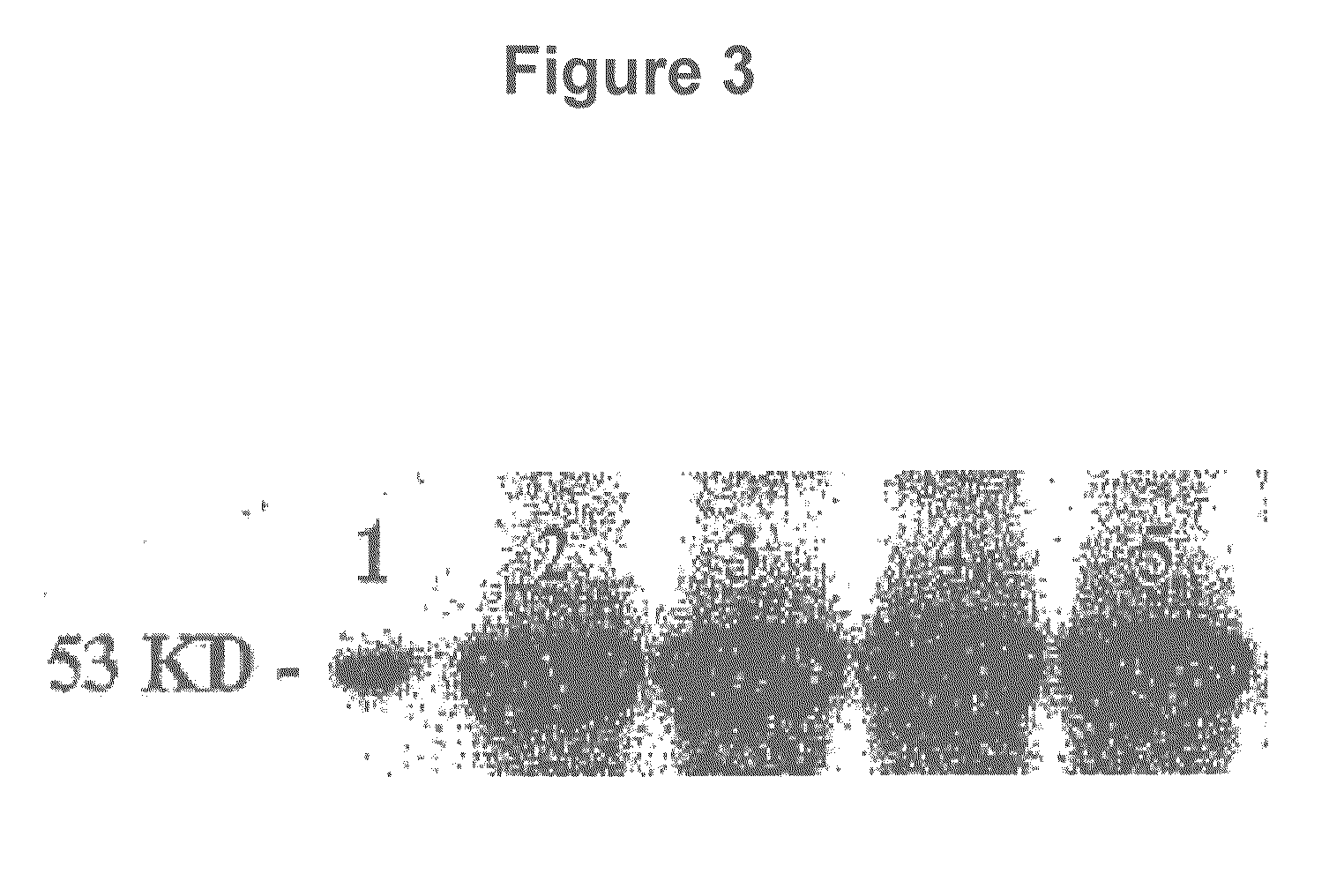 Apoptosis-Modulating Protein Therapy for Proliferative Disorders and Nanoparticles Containing the Same