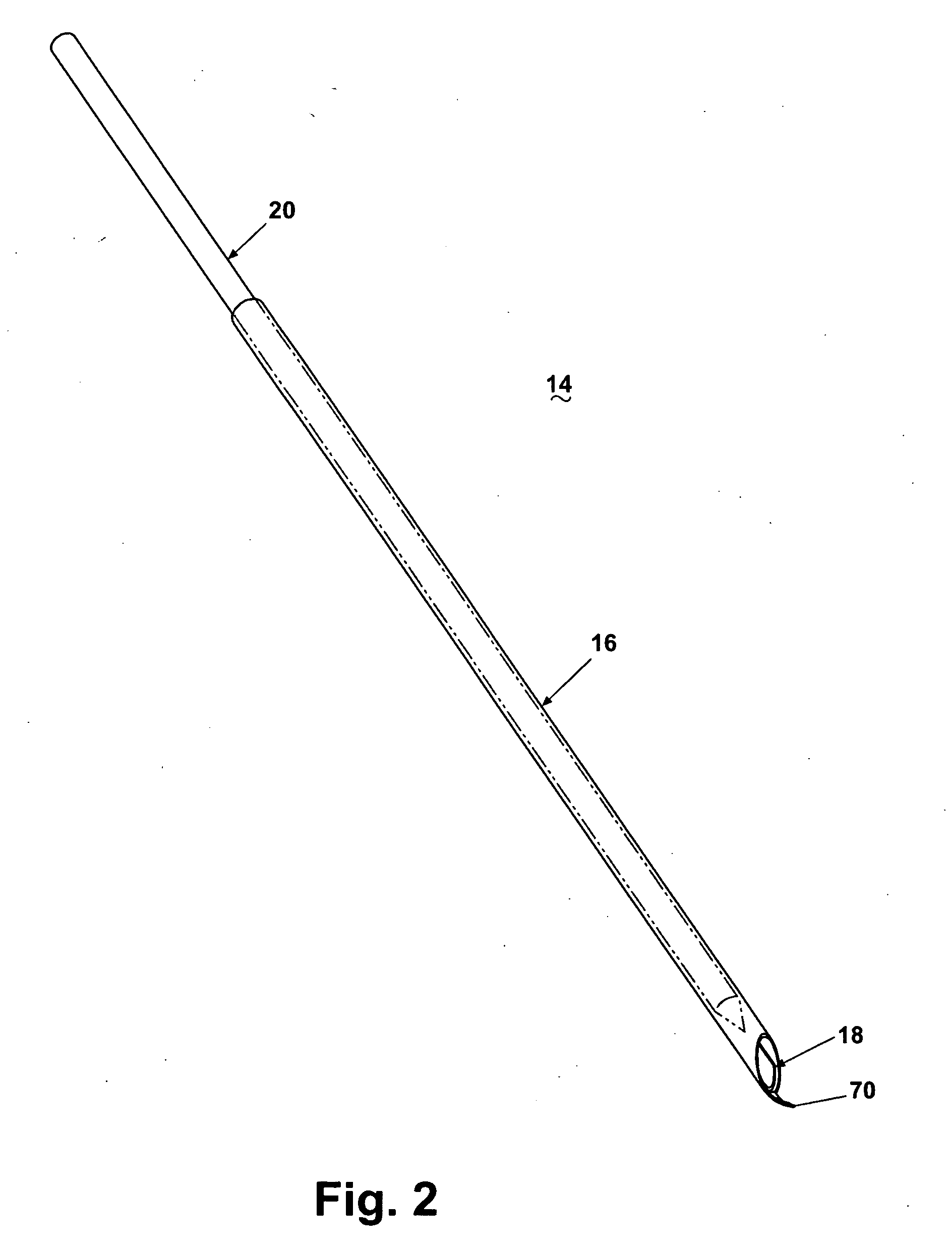 Core Biopsy Device with Specimen Length Adjustment