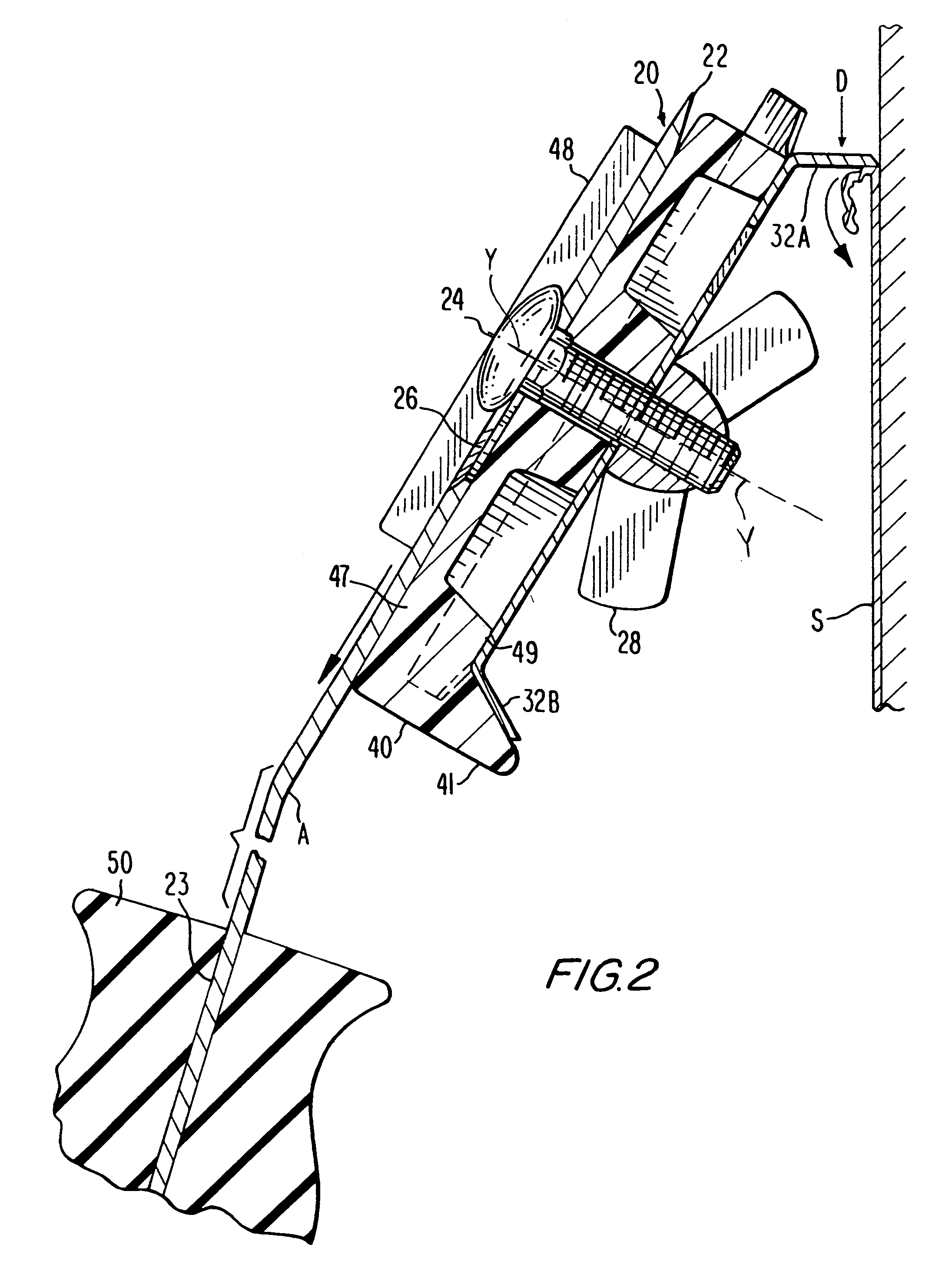 Push-pull stripper-scraper