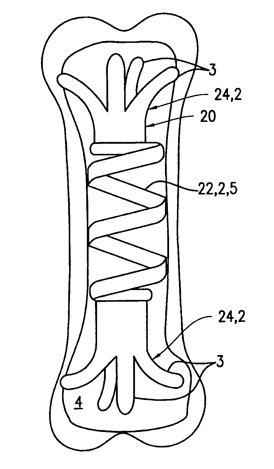 Fixation device