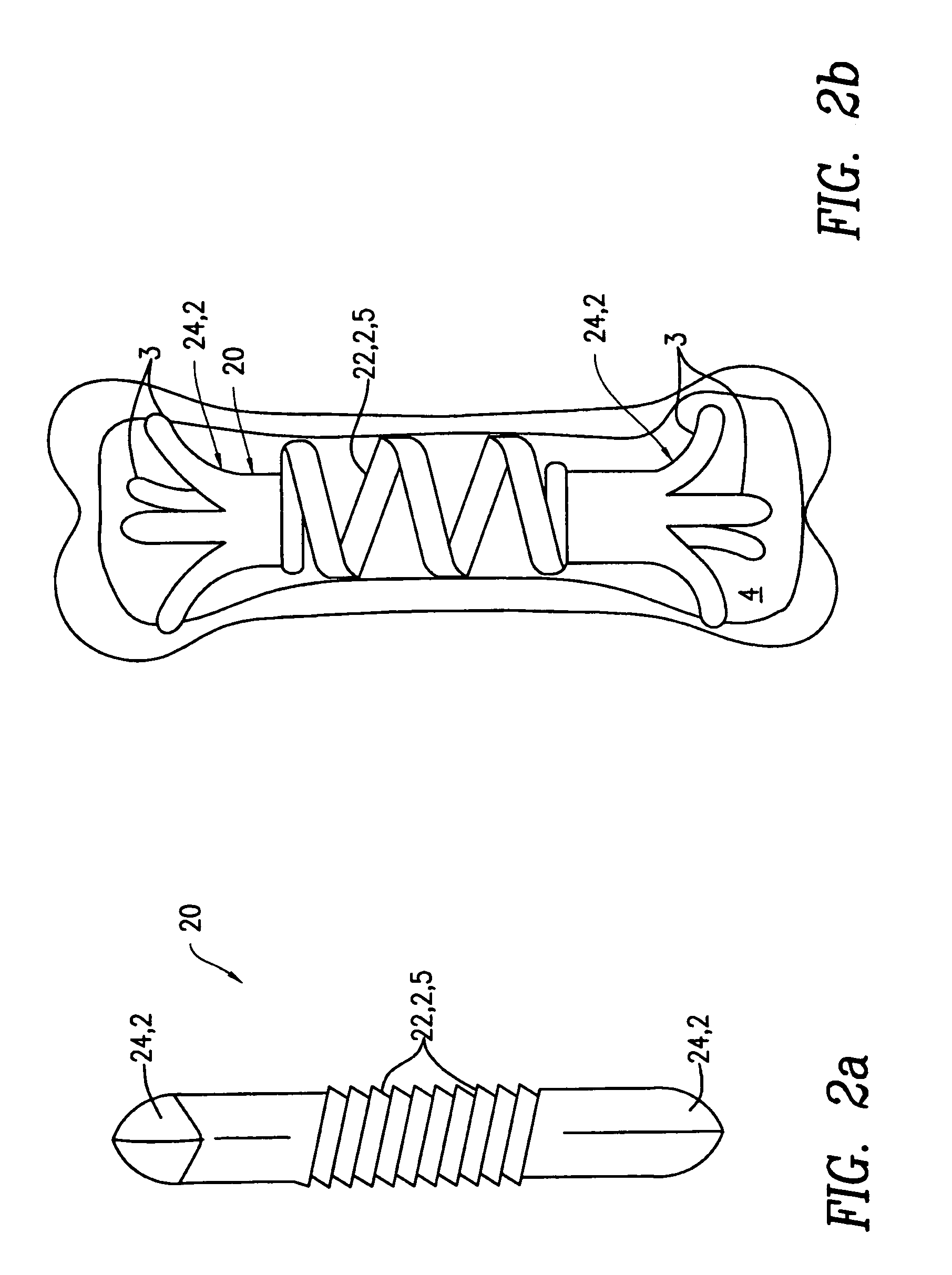 Fixation device