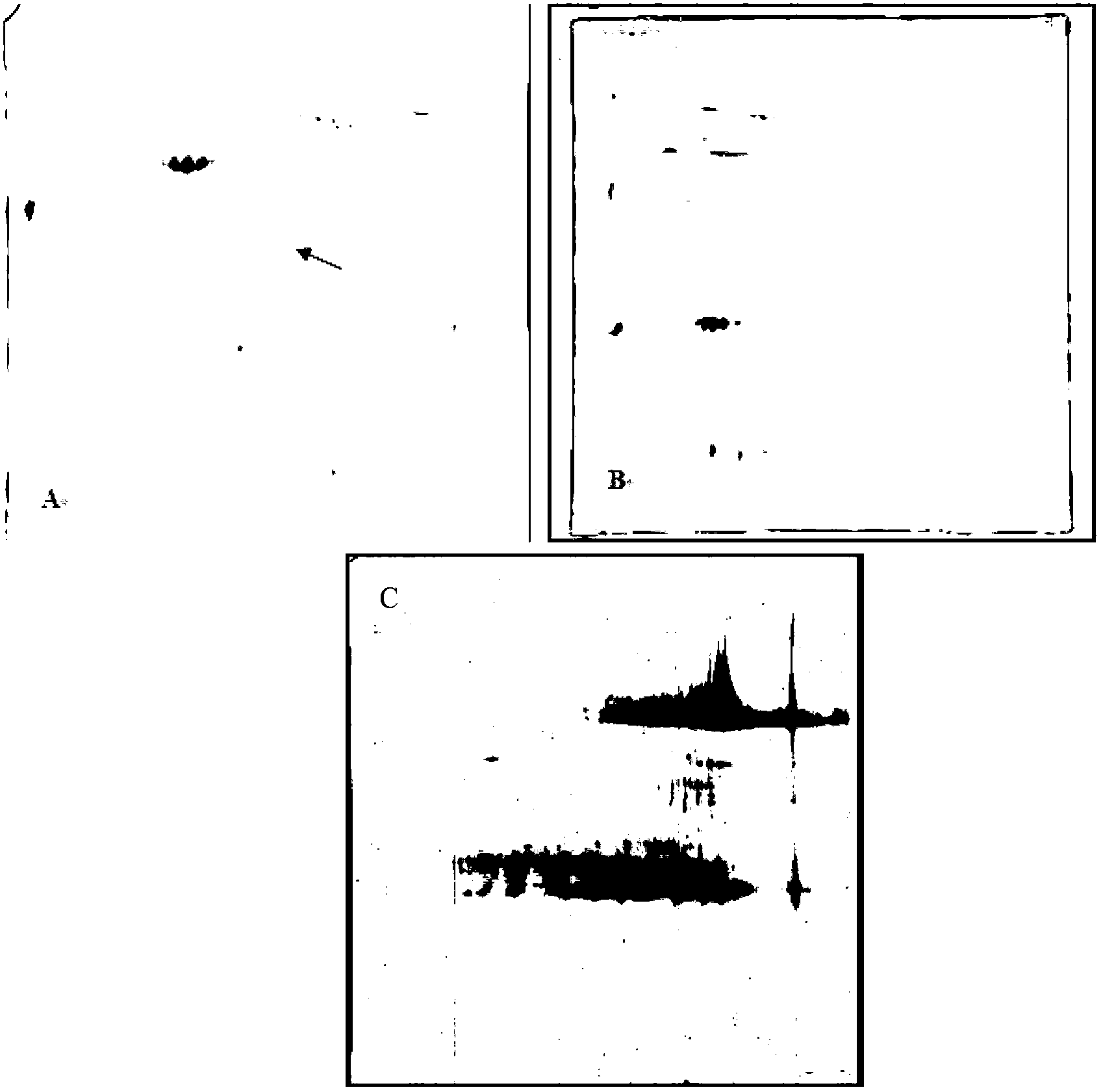 Circulating immune complex of peroxide reductase IV and application of complex