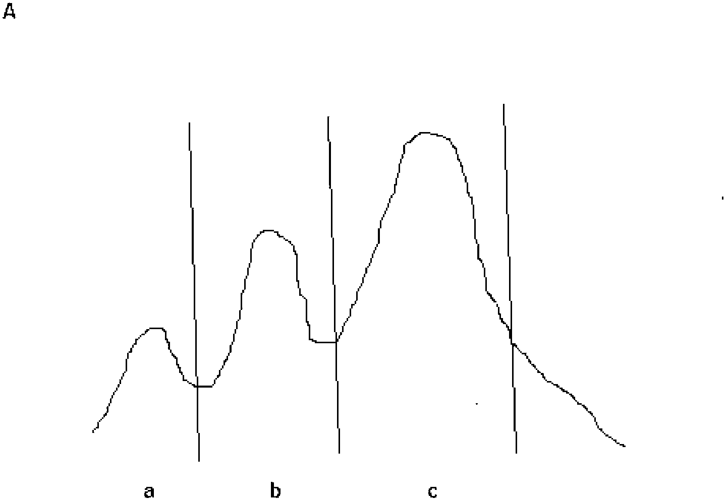 Circulating immune complex of peroxide reductase IV and application of complex