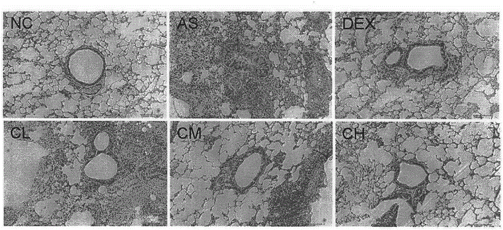 Use of calycosin-7-glucoside in preparation of drugs for treating asthma