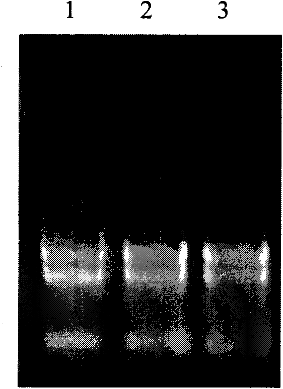 Method for extracting total RNA from plant tissue rich in polysaccharides and polyphenols and secondary metabolites