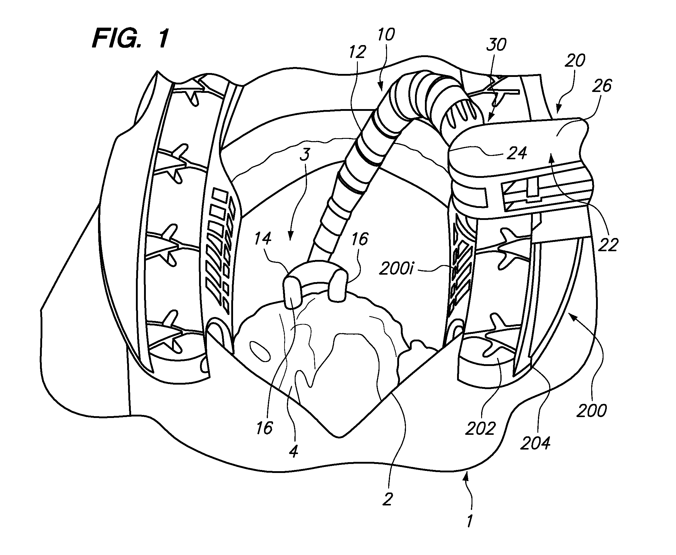 Surgical instruments, systems and methods of use