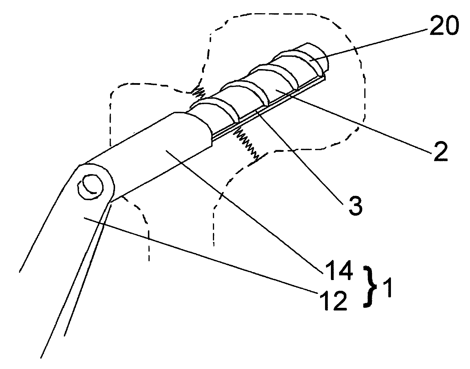 Anti-subsidence dynamic hip screw