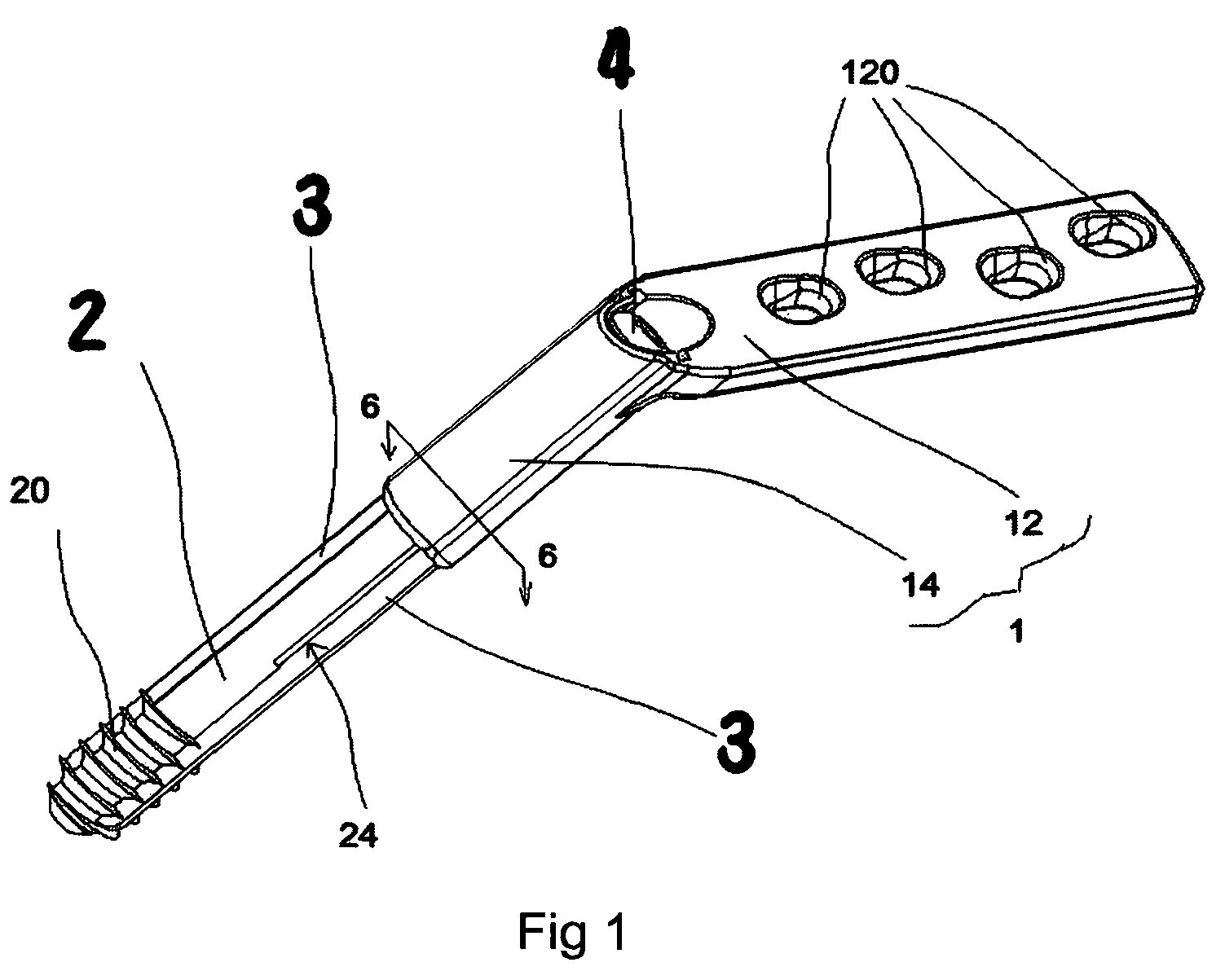 Anti-subsidence dynamic hip screw