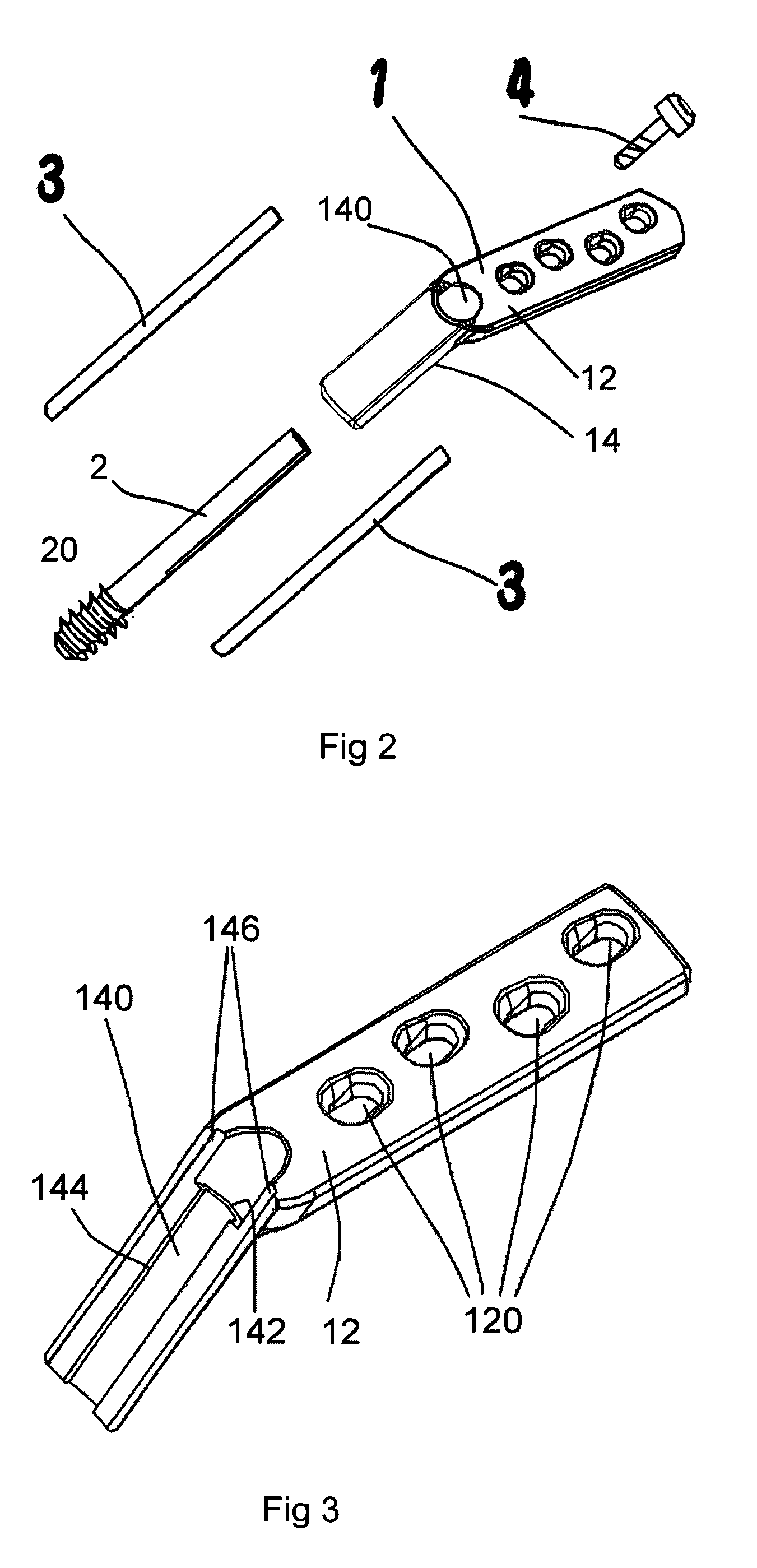 Anti-subsidence dynamic hip screw