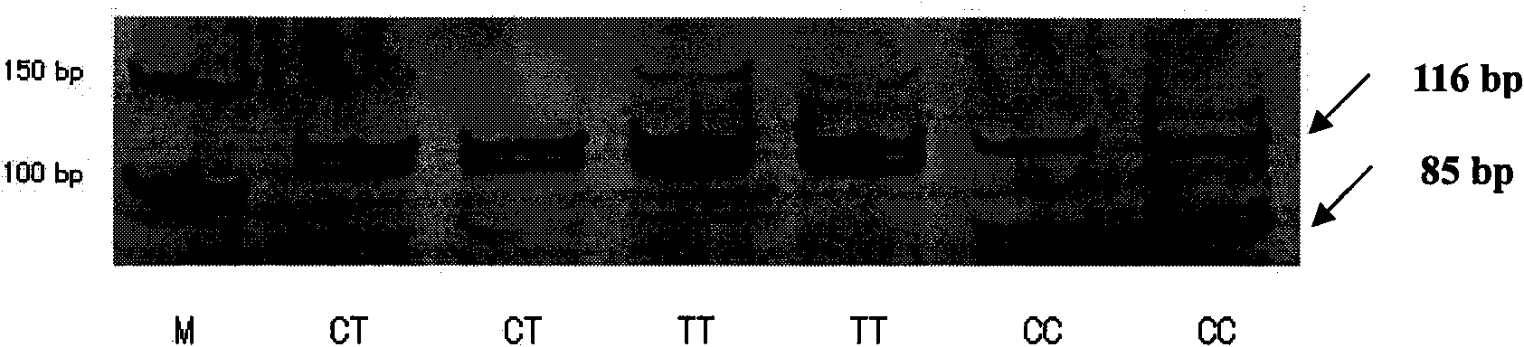 Method for detecting single nucleotide polymorphism (SNP) of ox PRDM16 gene