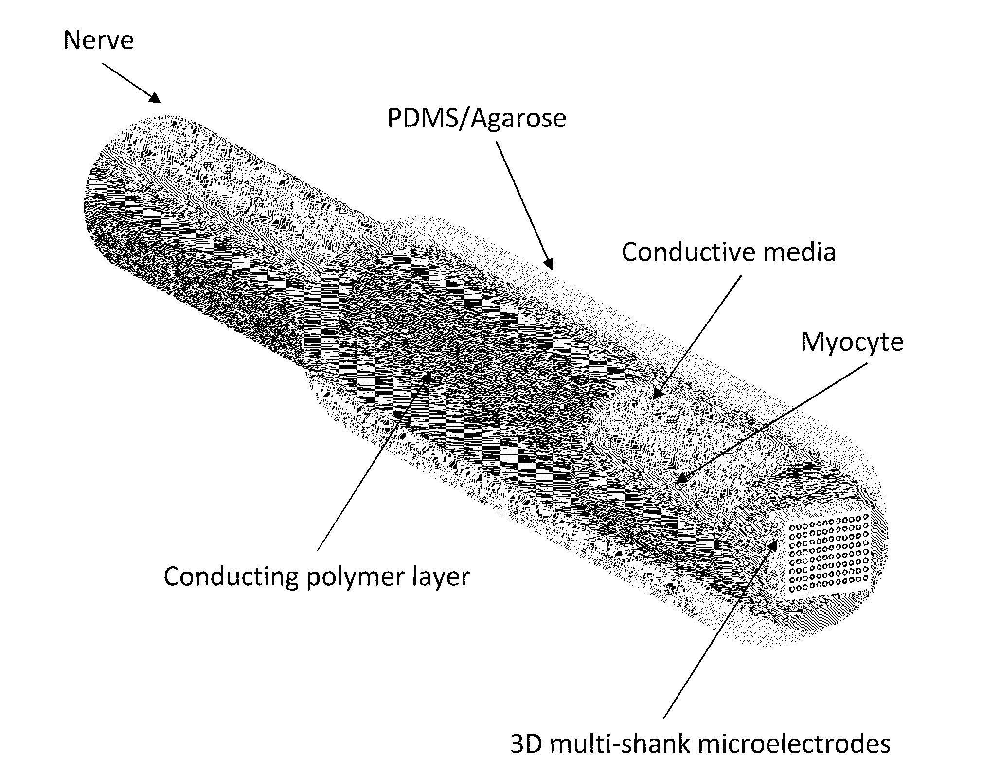 Hybrid bioelectrical interface device