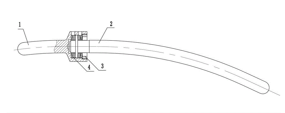 Elastic orthopedic stick for internal fixation of spines