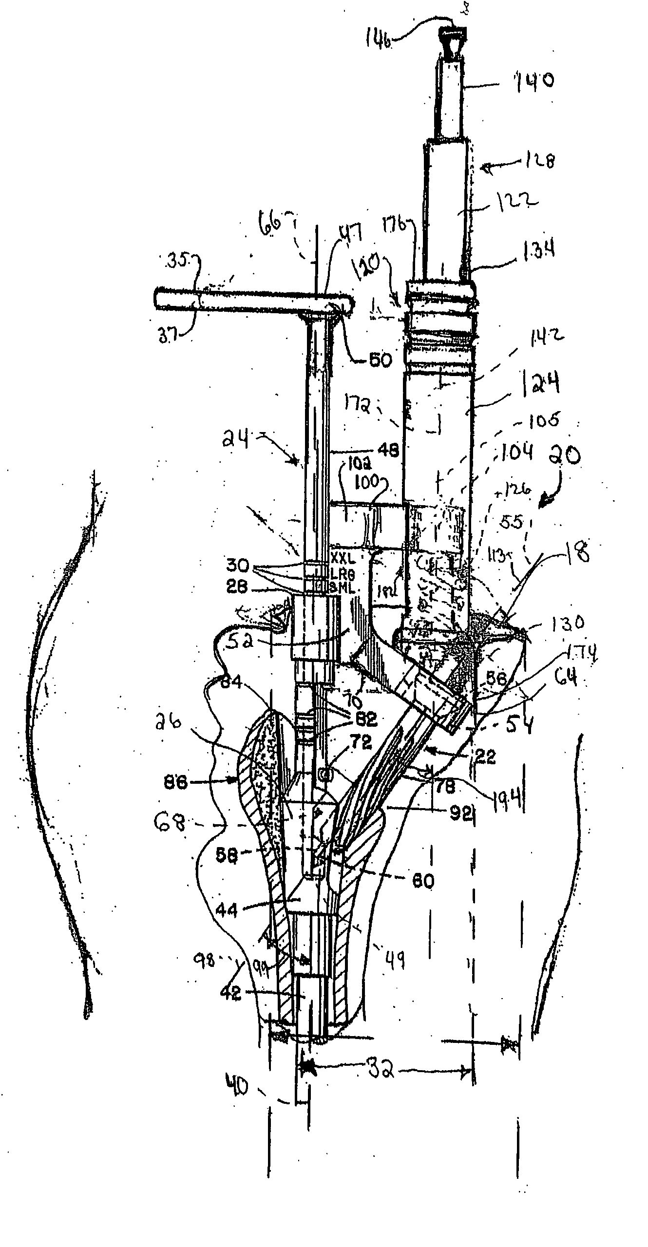 Minimally invasive bone miller apparatus