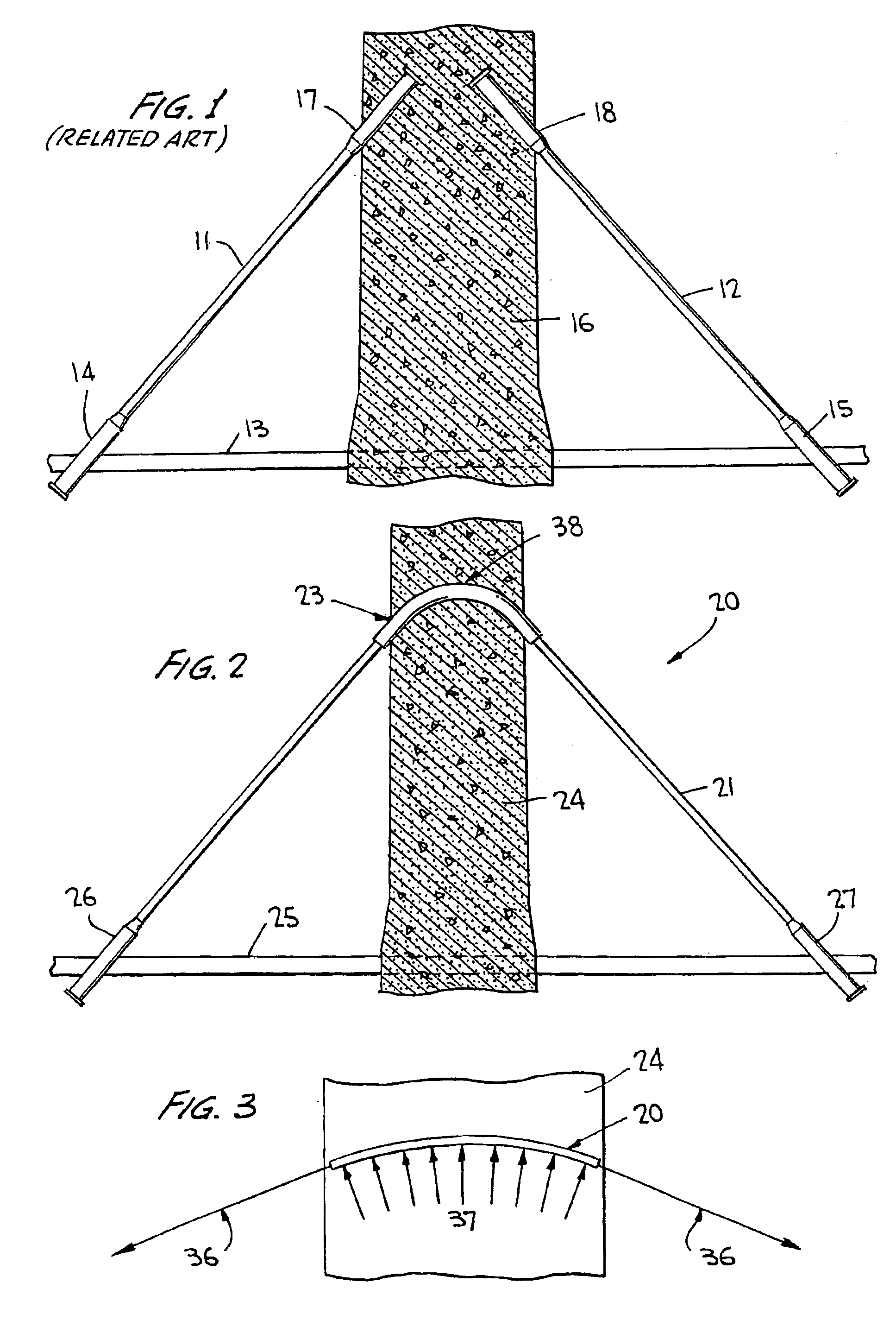 Cable-stay cradle system