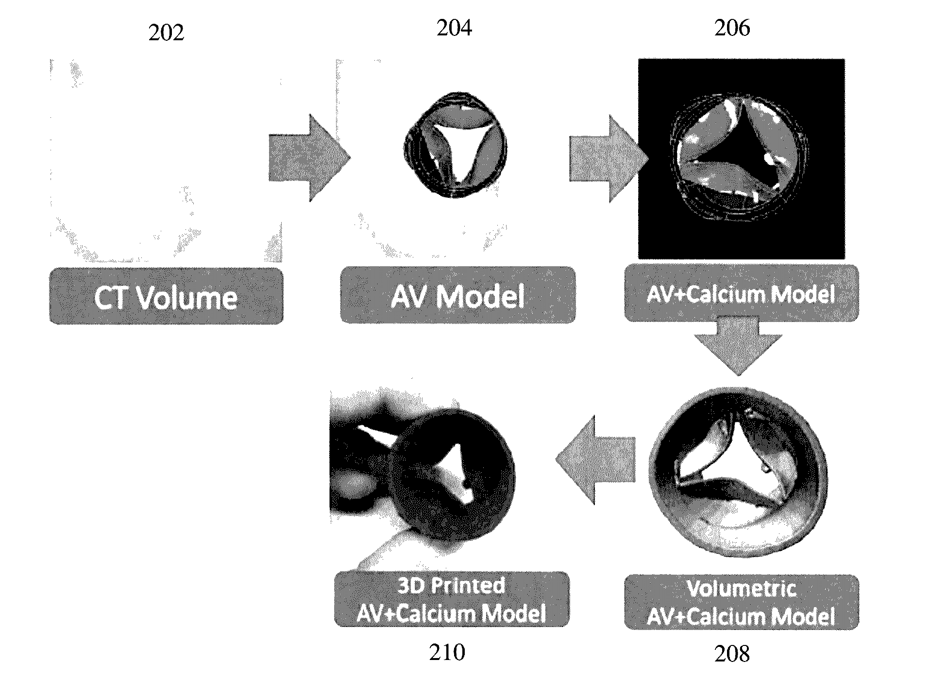 Method and System for Advanced Transcatheter Aortic Valve Implantation Planning