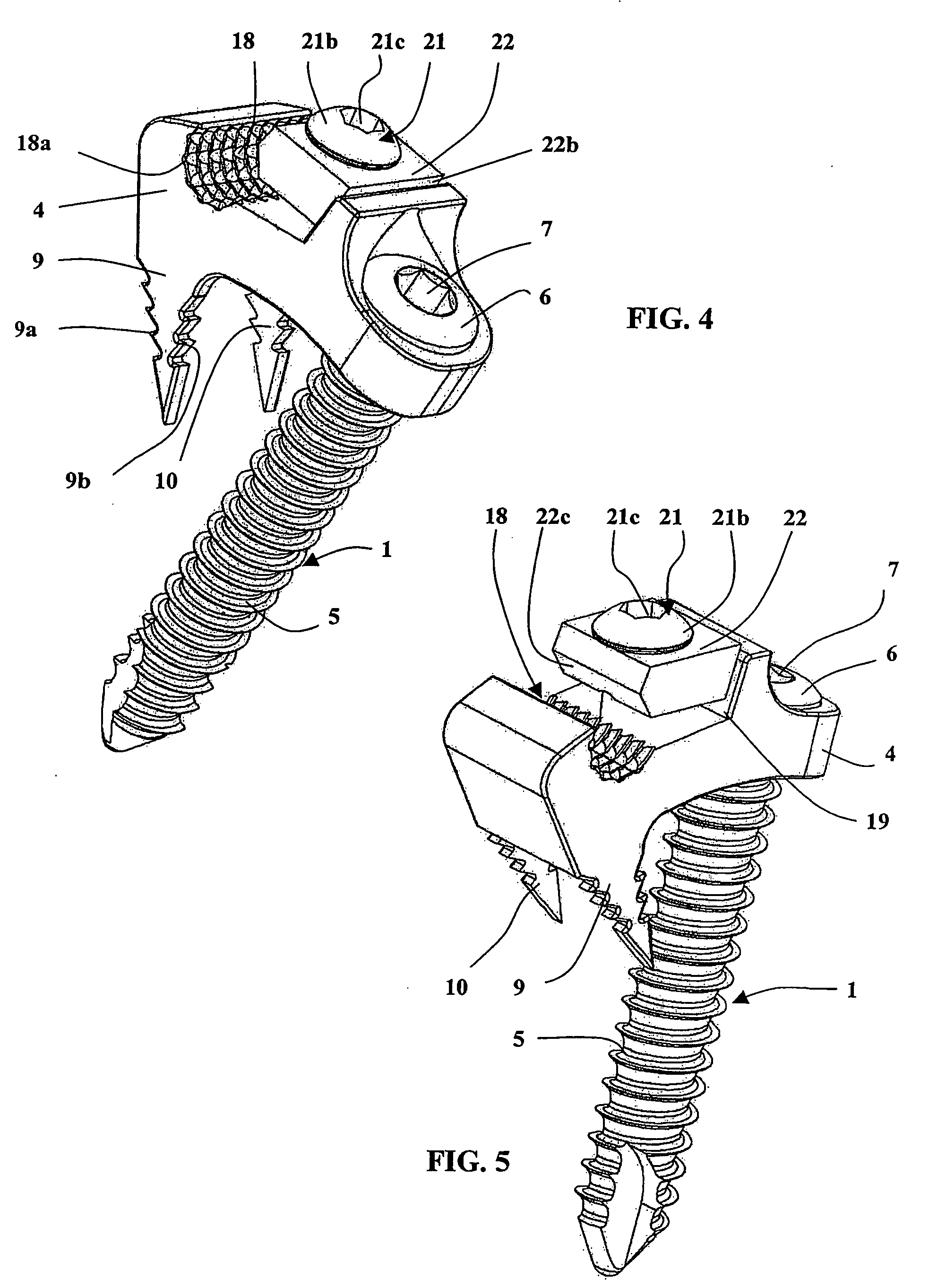 Device comprising anterior plate for vertebral column support