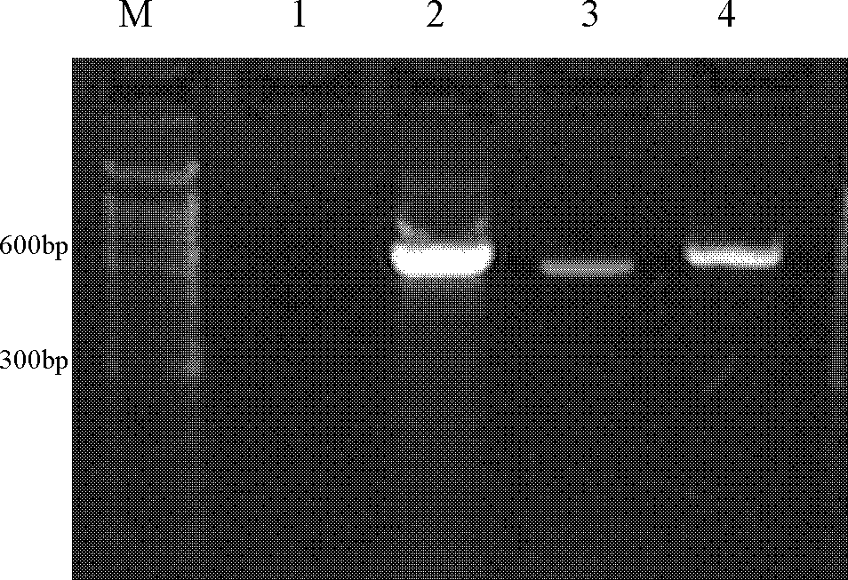 Fungus colony polymerase chain reaction (PCR) method and pathogenic fungus identification method