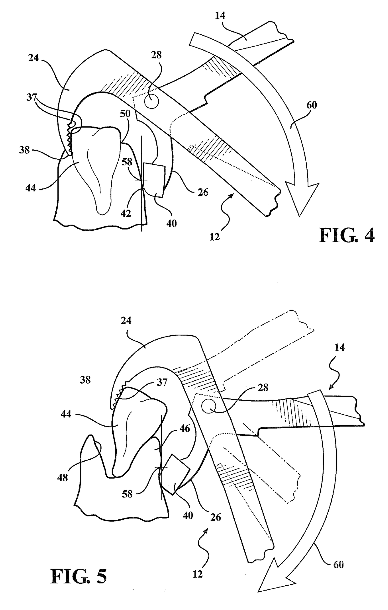 Dental plier design with offsetting jaw and pad elements for assisting in removing upper and lower teeth utilizing the dental plier design