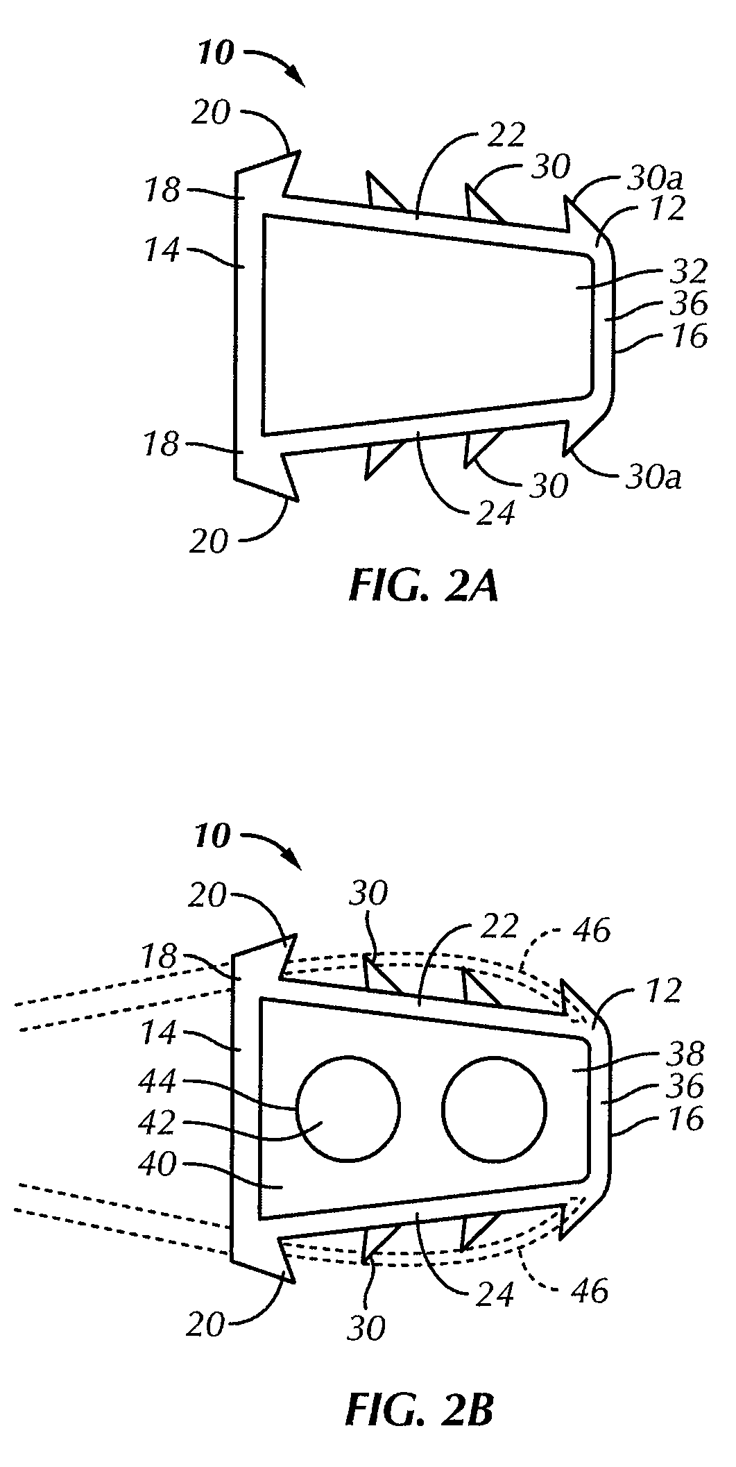 Cervical fixation device