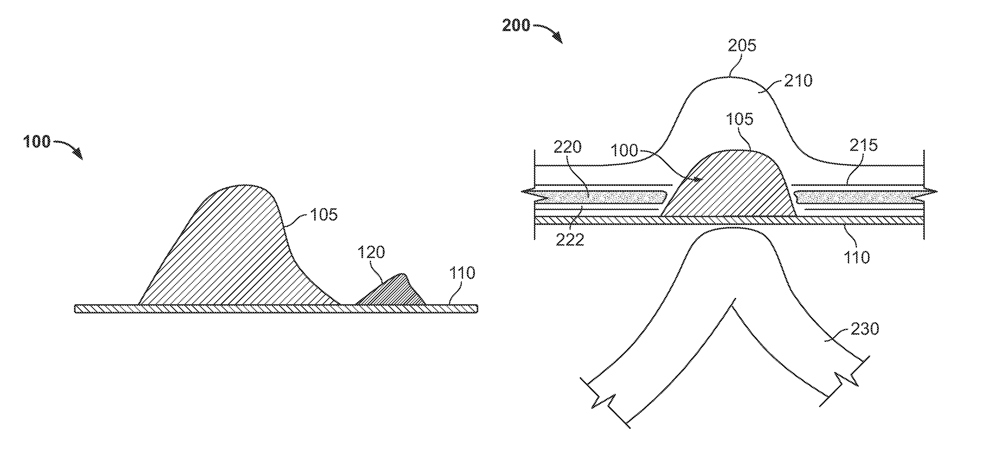 Hernia mesh apparatus and method