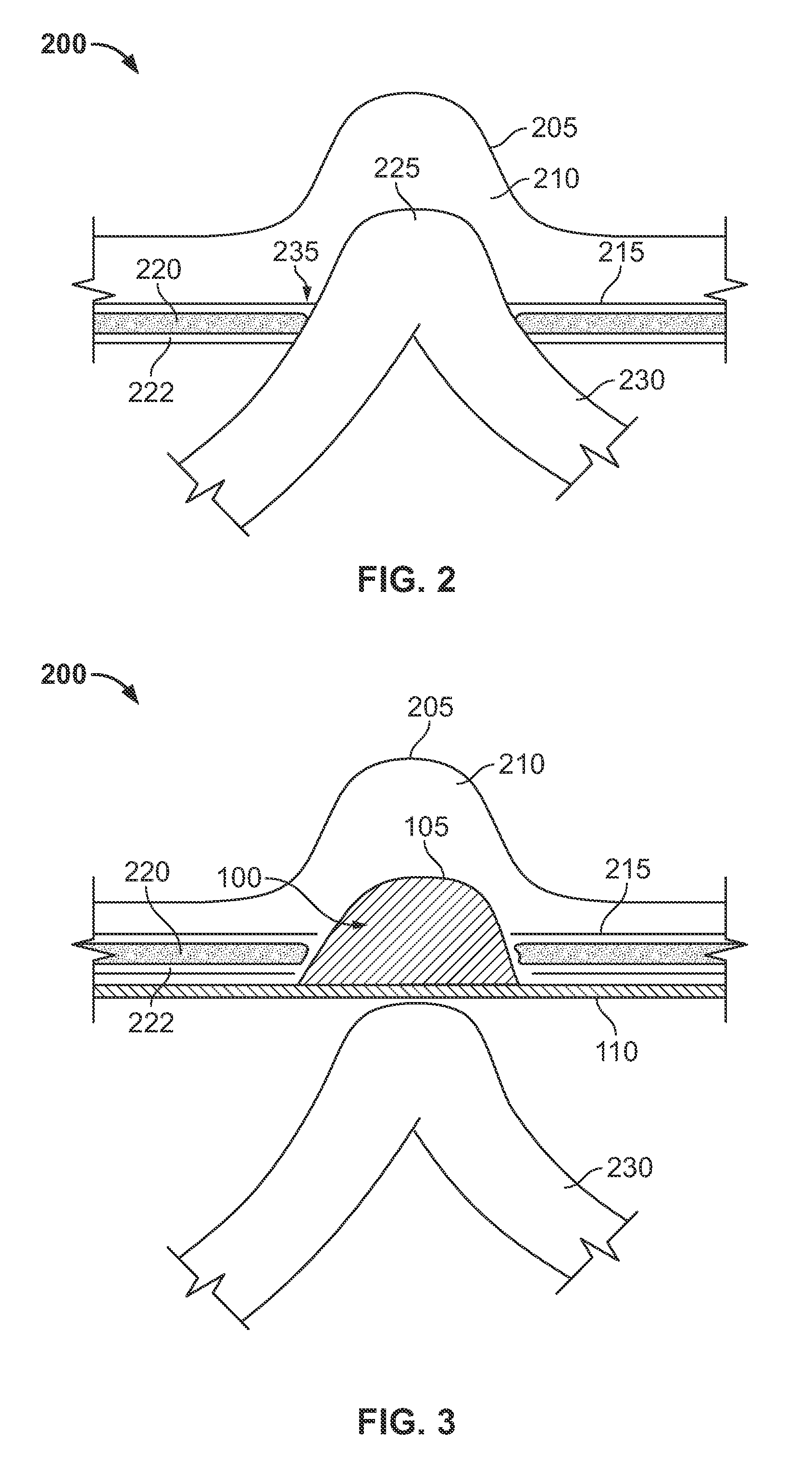 Hernia mesh apparatus and method