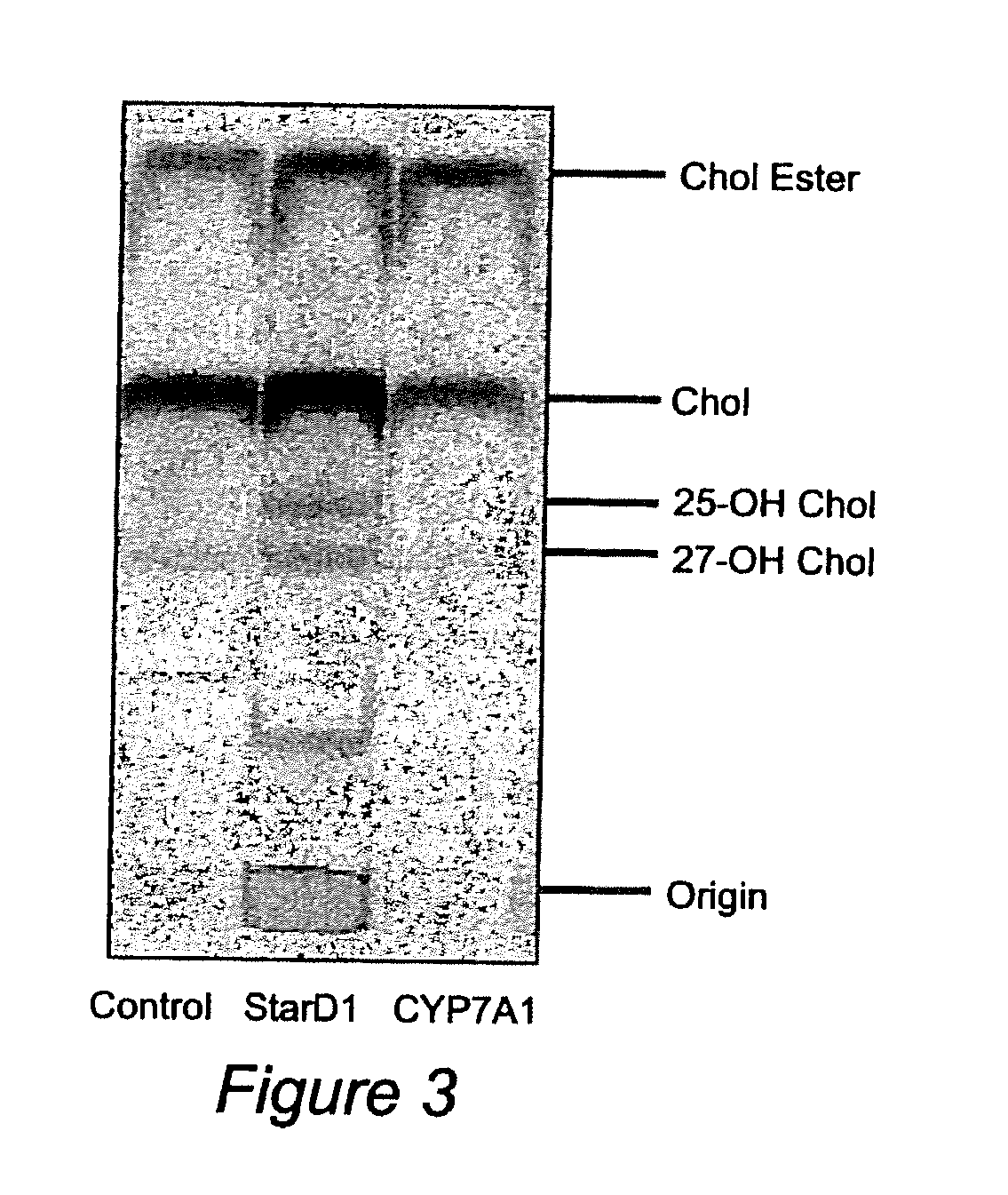 Nuclear Sulfated Oxysterol, Potent Regulator of Lipid Homeostasis, for Therapy of Hypercholesterolemia, Hypertriglycerides, Fatty Liver Diseases, and Atherosclerosis