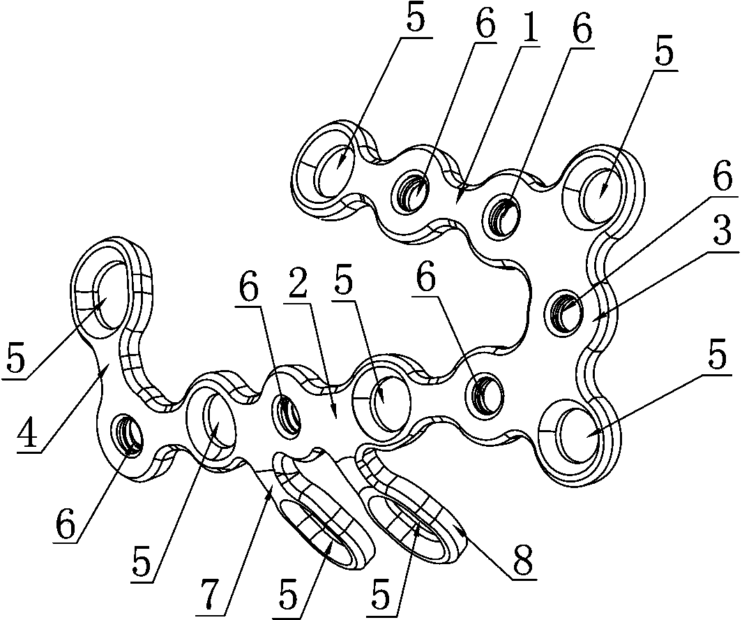 Anatomic calcaneus locking bone plate