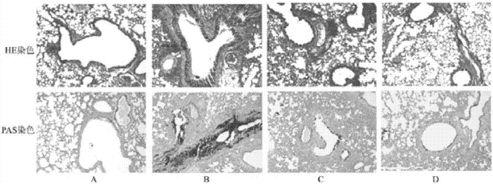 Pharmaceutical composition for treating asthma