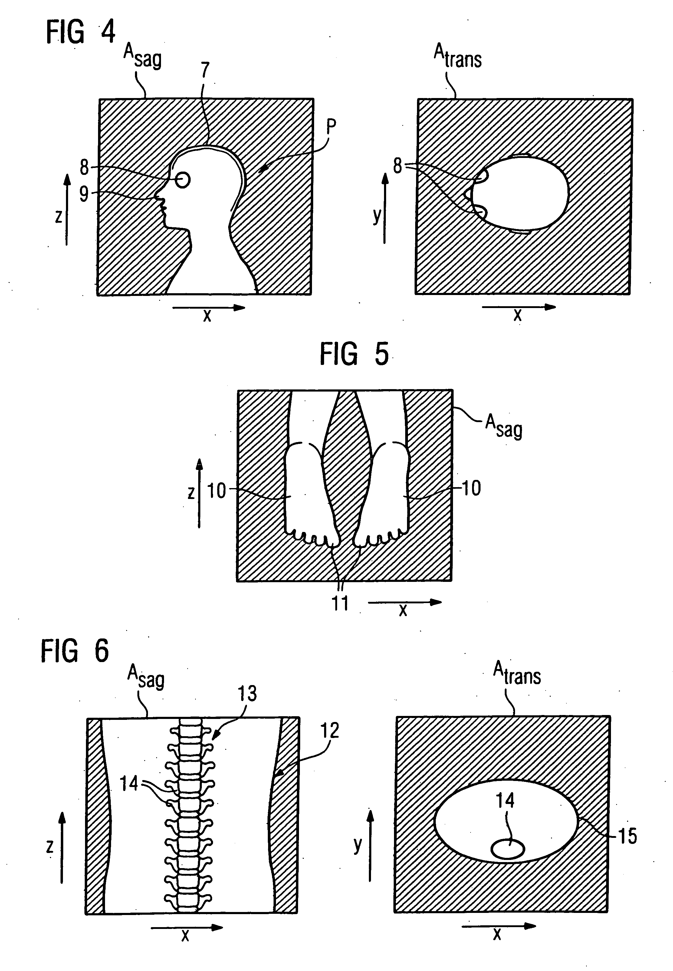 Method for determination of the supported position of a patient in a magnetic resonance apparatus