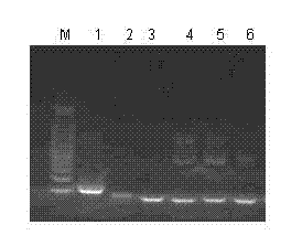 In-vitro inducing method for high-expression Nurrl gene of human mesenchymal stem cell