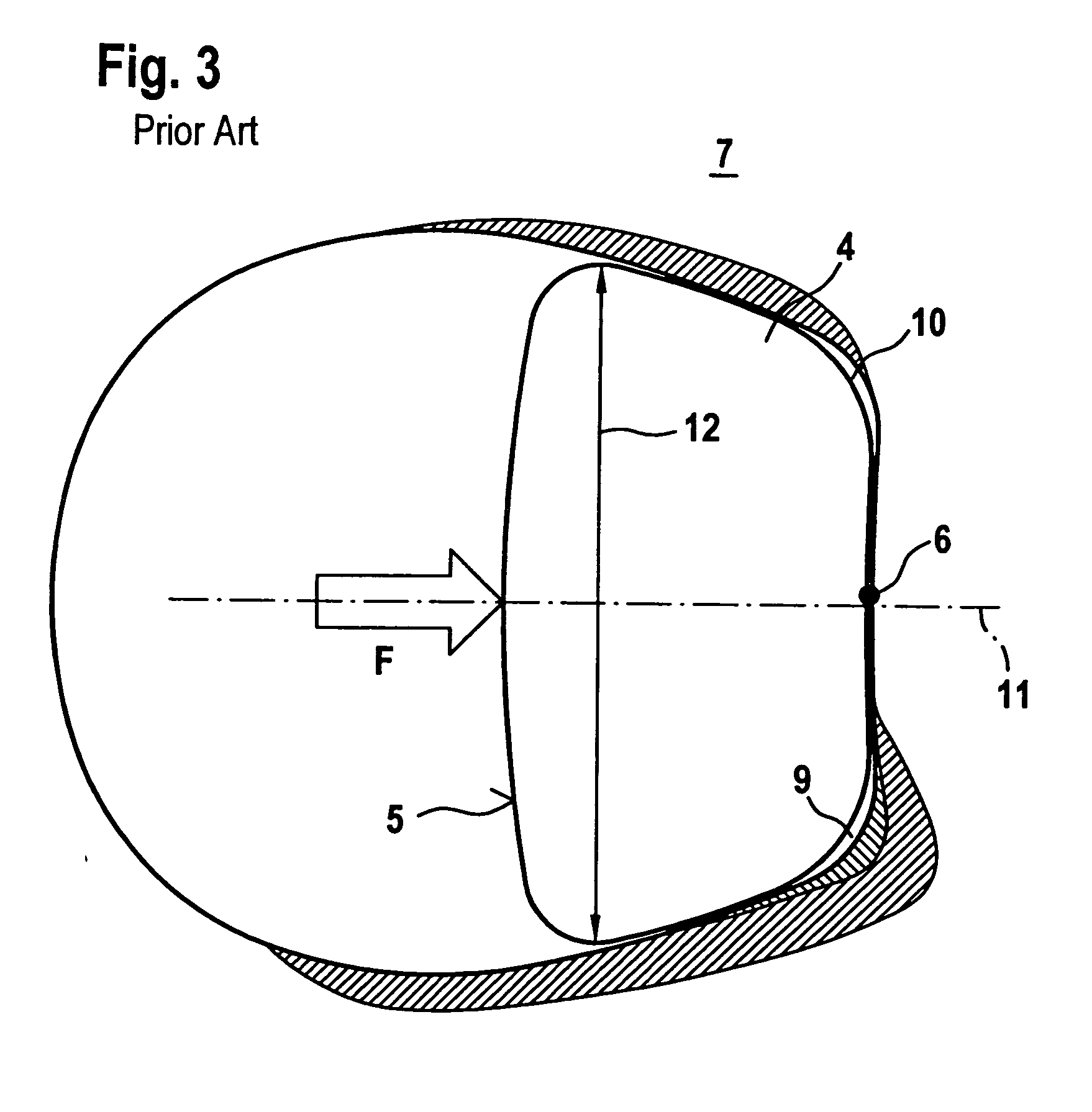 Plate-link chain, particularly for a motor vehicle drive system