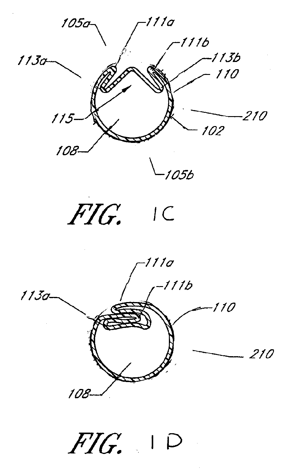 Expandable medical access sheath