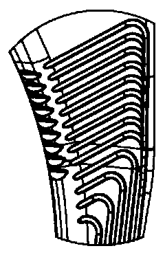 Hip joint prosthesis