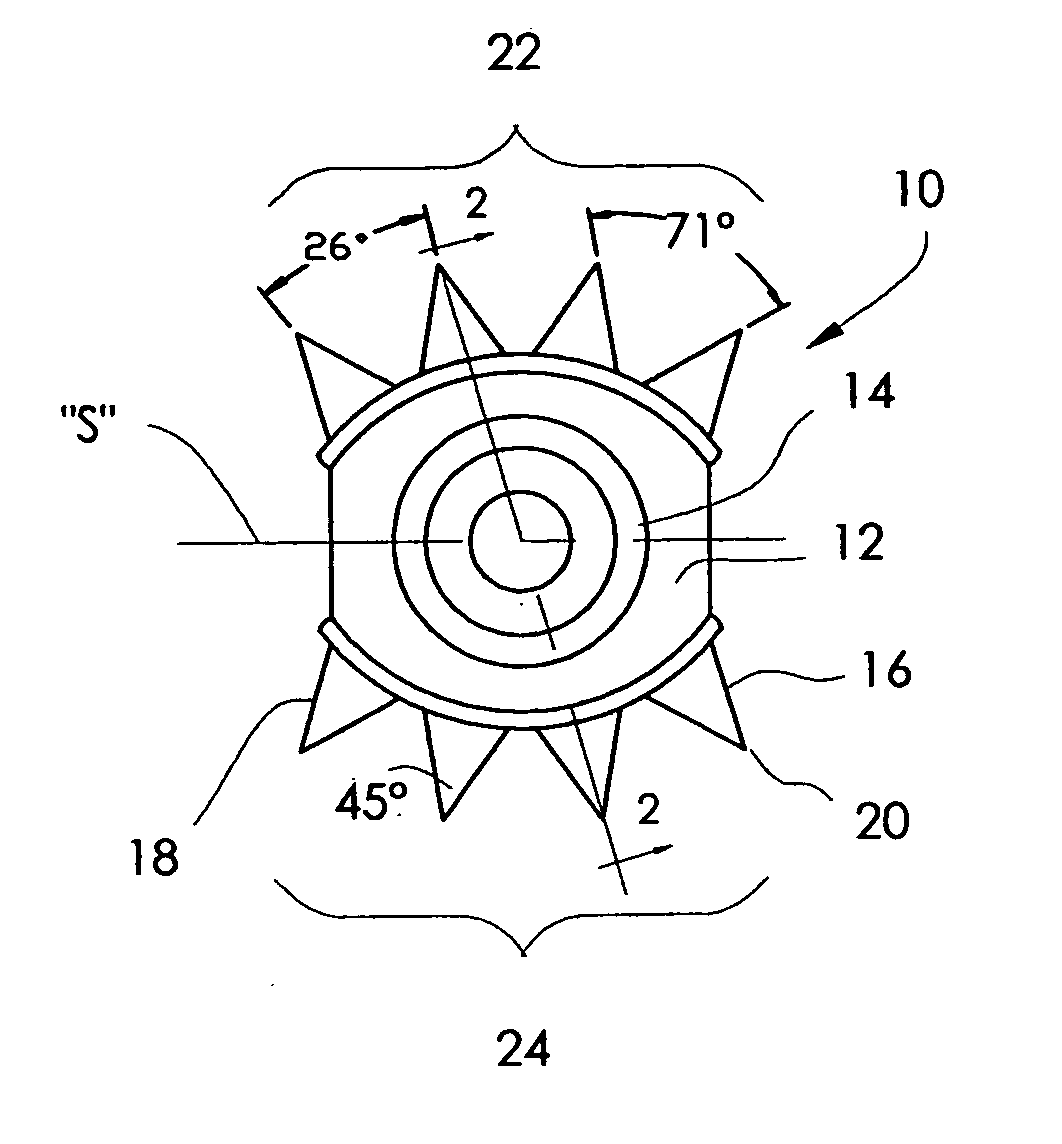 Ring binder mechanism with pronged metal anchors